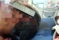 1761673161168-mj-korban-penebasan-parang-oleh-saudara-kandung-di-lombok-timur-minggu-26102025-mj-dianiaya-akibat-sengketa-tanah-warisan-dok--1761661567083_169