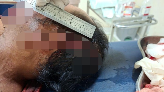 1761673161168-mj-korban-penebasan-parang-oleh-saudara-kandung-di-lombok-timur-minggu-26102025-mj-dianiaya-akibat-sengketa-tanah-warisan-dok--1761661567083_169